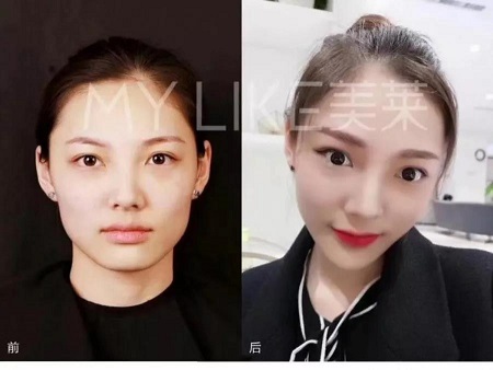 再不糾正,早晚這幾點(diǎn)會(huì)毀了你的臉型!