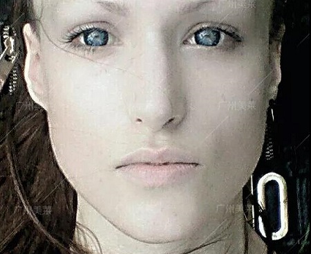 約醫(yī)師 | 3月21日，國(guó)際乳房整容醫(yī)師穆大力來(lái)了！親診名額限量預(yù)約！