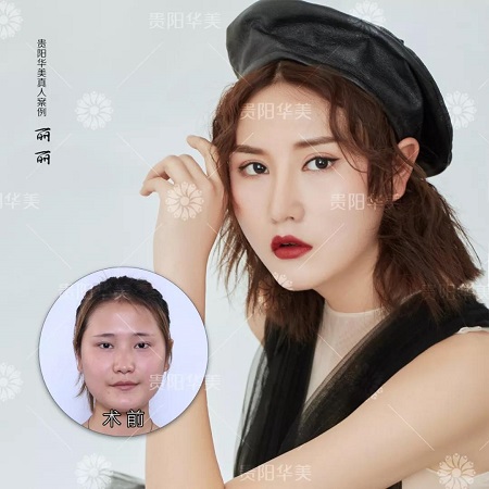 會(huì)縫衣服就會(huì)割雙眼皮！3天速成還用朋友試手？