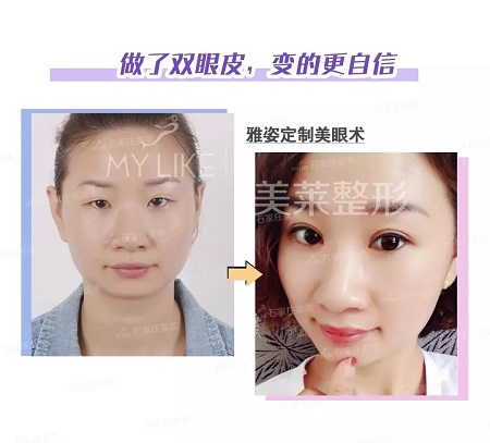 注意啦！這些眼睛一點(diǎn)都不招人喜歡！