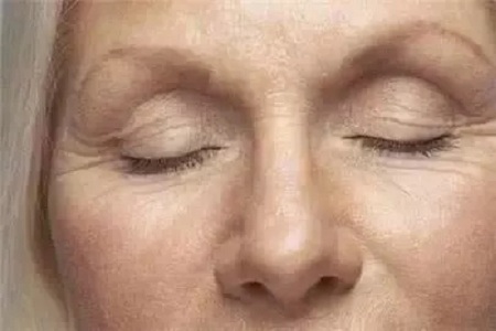 杭州玻尿酸除皺整形多少錢