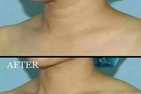 做了*雕的和沒有做的區(qū)別有多大？