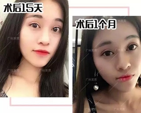 這3種小眼睛開(kāi)了眼角，電眼迷人1000倍！