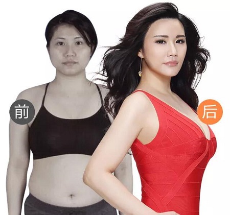 3月27-28日，世界吸脂王志軍來了！