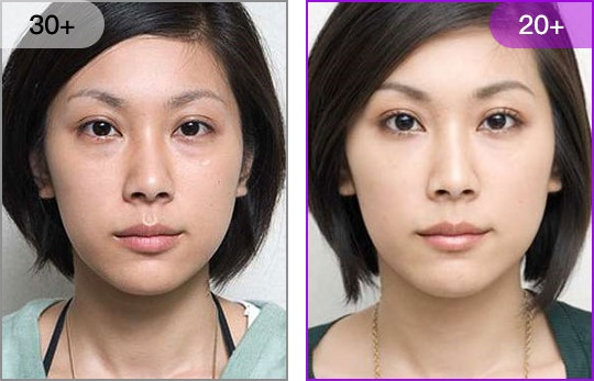 杭州祛眼袋哪里做好？