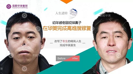 【真人秀】別再問隆鼻難不難做，沒有鼻子都能變出來！