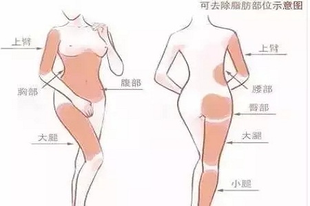 微創(chuàng)吸脂手術(shù)多少錢(qián)