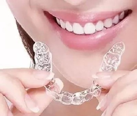 你以為他們整容了，其實他們只是做了牙齒矯正。