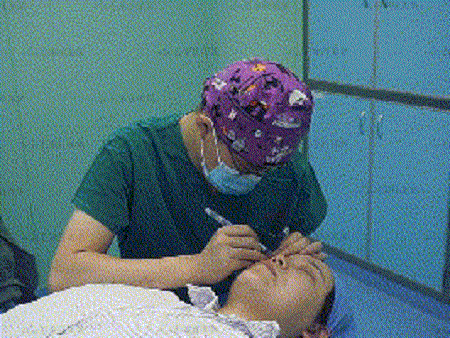 我是腫眼泡，該做雙眼皮還是吸脂？