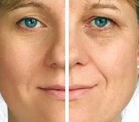 熬較狠的夜，其實也不用買較貴的眼霜！注射玻尿酸和玻尿酸就夠了！