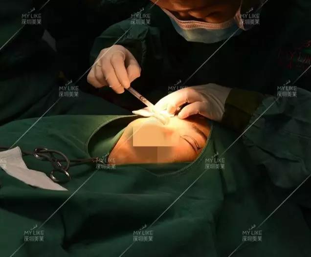 <a href='/ybzx/syp/' target='_blank'><u>割雙眼皮</u></a>到底痛不痛？