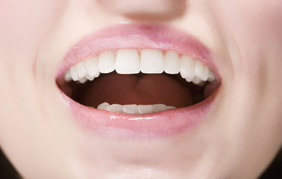 冷光美白牙齒要多少錢？