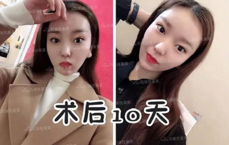 天天喊著要減肥！減肥！但，你真的胖嗎？