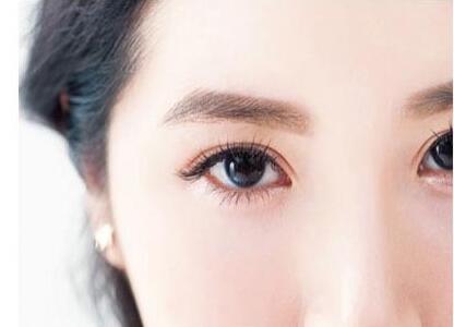 吸脂去眼袋后會反彈嗎？