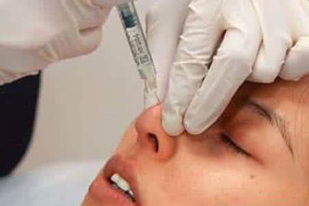 隆鼻是假體好還是注射好？