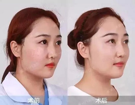 賦活水光3次399元、水光買一送一...春季水光專場，爆款限時搶！