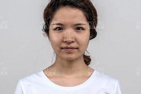 抗初老警報！萬物皆上漲、唯有臉下垂，你還說你不是老阿姨