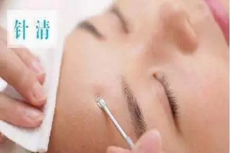 擠痘竟然被送進ICU！你的痘痘還好嗎？