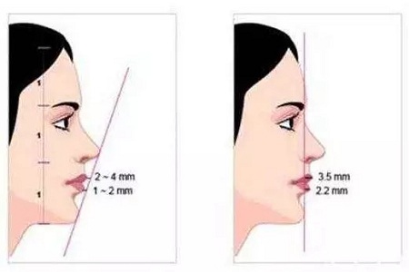 從“側(cè)顏癱”到“側(cè)顏殺”，其實(shí)只需要一點(diǎn)小改變