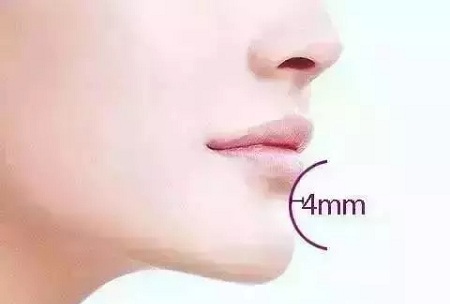 從“側(cè)顏癱”到“側(cè)顏殺”，其實(shí)只需要一點(diǎn)小改變