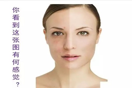 抗衰老的“水光”究竟為何飽受稱贊？