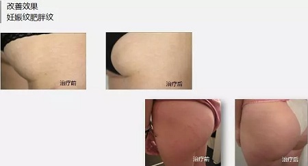 抗衰老的“水光”究竟為何飽受稱贊？