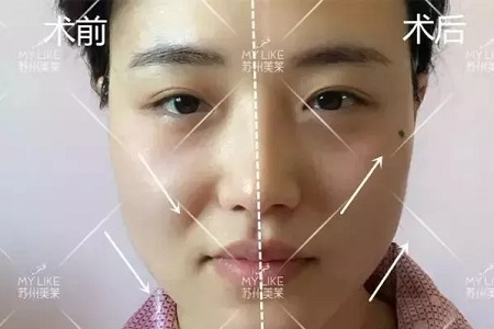 沒有誰能永遠(yuǎn)年輕，不老都是保養(yǎng)的早！