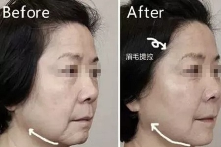 沒有誰能永遠(yuǎn)年輕，不老都是保養(yǎng)的早！