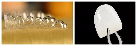 矯正 PK 牙貼面！關(guān)閉牙縫應(yīng)該pick哪一個(gè)？