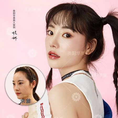 想要美眼俏鼻？來(lái)華美讓你擁有開掛人生！