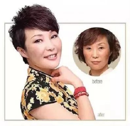 天天喊著要除皺的你，確定抗衰做到位了么？