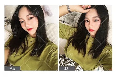 顏值：鼻子的改變能讓一個女孩變化有多大？