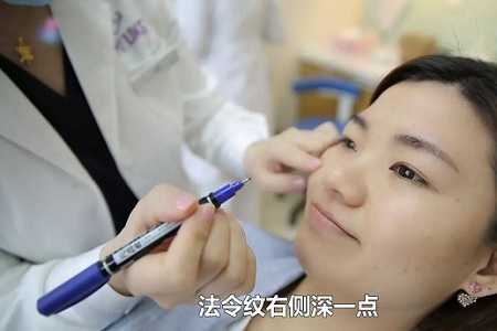 法令紋、川字紋