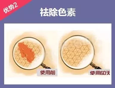 為什么瘦人也會(huì)有“肥胖紋”？