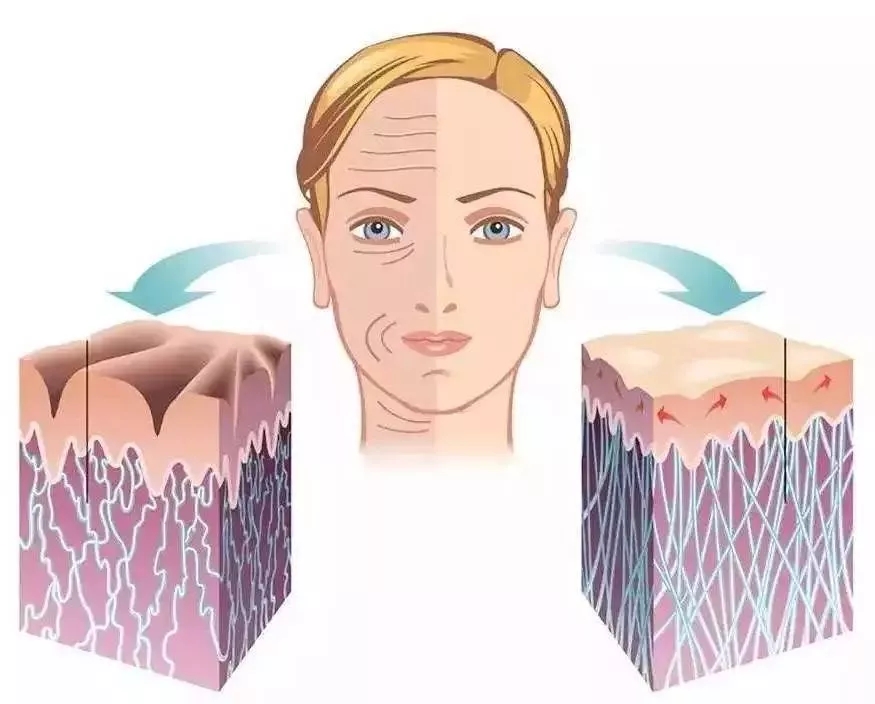 你討厭的脂肪，用在臉上就是寶貝！