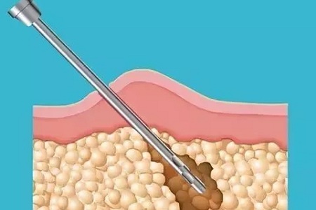 面對減肥這件事，一定要保持頭腦清醒！