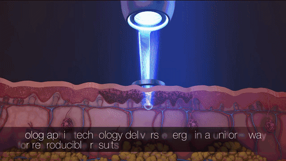 祛了那么多年的斑，你的斑去掉了嗎？