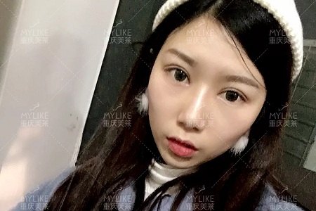 市面上五花八門的雙眼皮項目，如何有效找到你的菜？