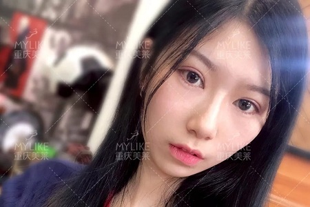 市面上五花八門的雙眼皮項目，如何有效找到你的菜？