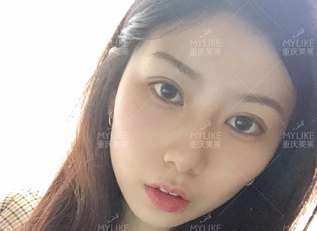 市面上五花八門的雙眼皮項目，如何有效找到你的菜？