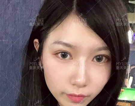 市面上五花八門的雙眼皮項目，如何有效找到你的菜？