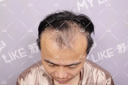 好看的皮囊千千萬，但都有一個共同點-頭發(fā)！