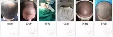 好看的皮囊千千萬，但都有一個共同點-頭發(fā)！