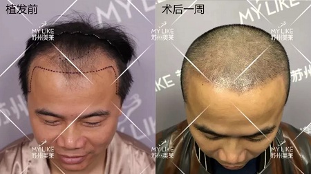 好看的皮囊千千萬，但都有一個共同點-頭發(fā)！