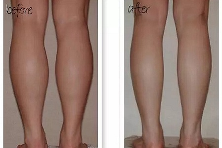 這有一個快速又持久瘦小腿的方法！請注意查收！