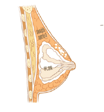 腿再瘦一點？腰再細一點？胸再大一點？自體脂肪填充，一步到位！