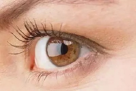 大小眼、不對(duì)稱，你是長(zhǎng)胖了還是真老了？