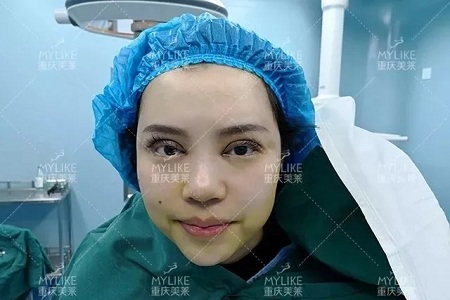 大小眼、不對(duì)稱，你是長(zhǎng)胖了還是真老了？