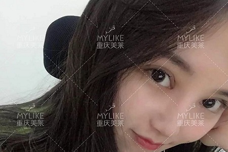 大小眼、不對(duì)稱，你是長(zhǎng)胖了還是真老了？