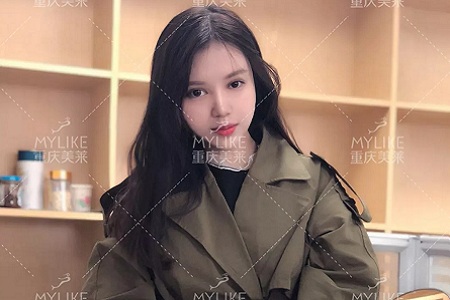 大小眼、不對(duì)稱，你是長(zhǎng)胖了還是真老了？